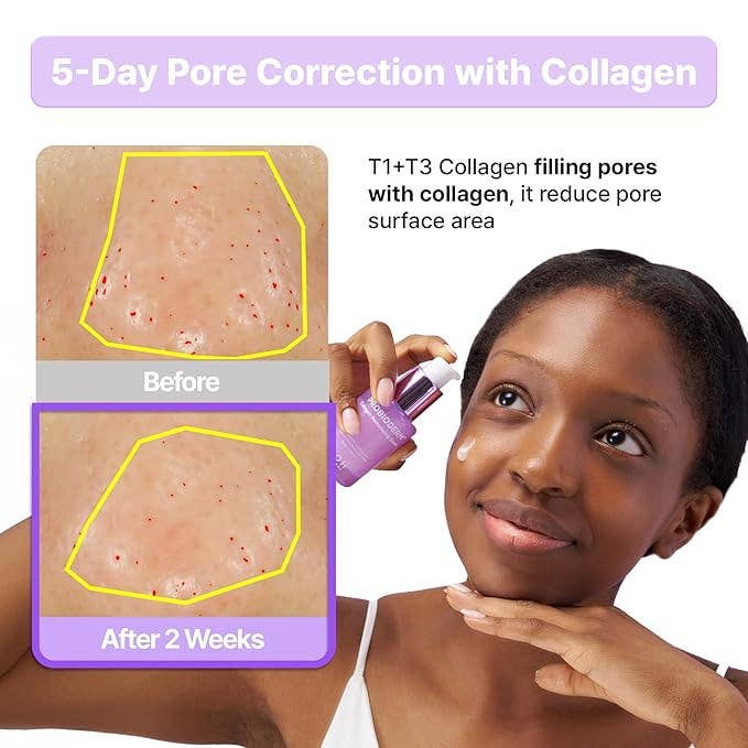 BIOHEAL BOH Probioderm™ Collagen Remodeling Serum 1.01 fl oz (30 ml) - Image 2