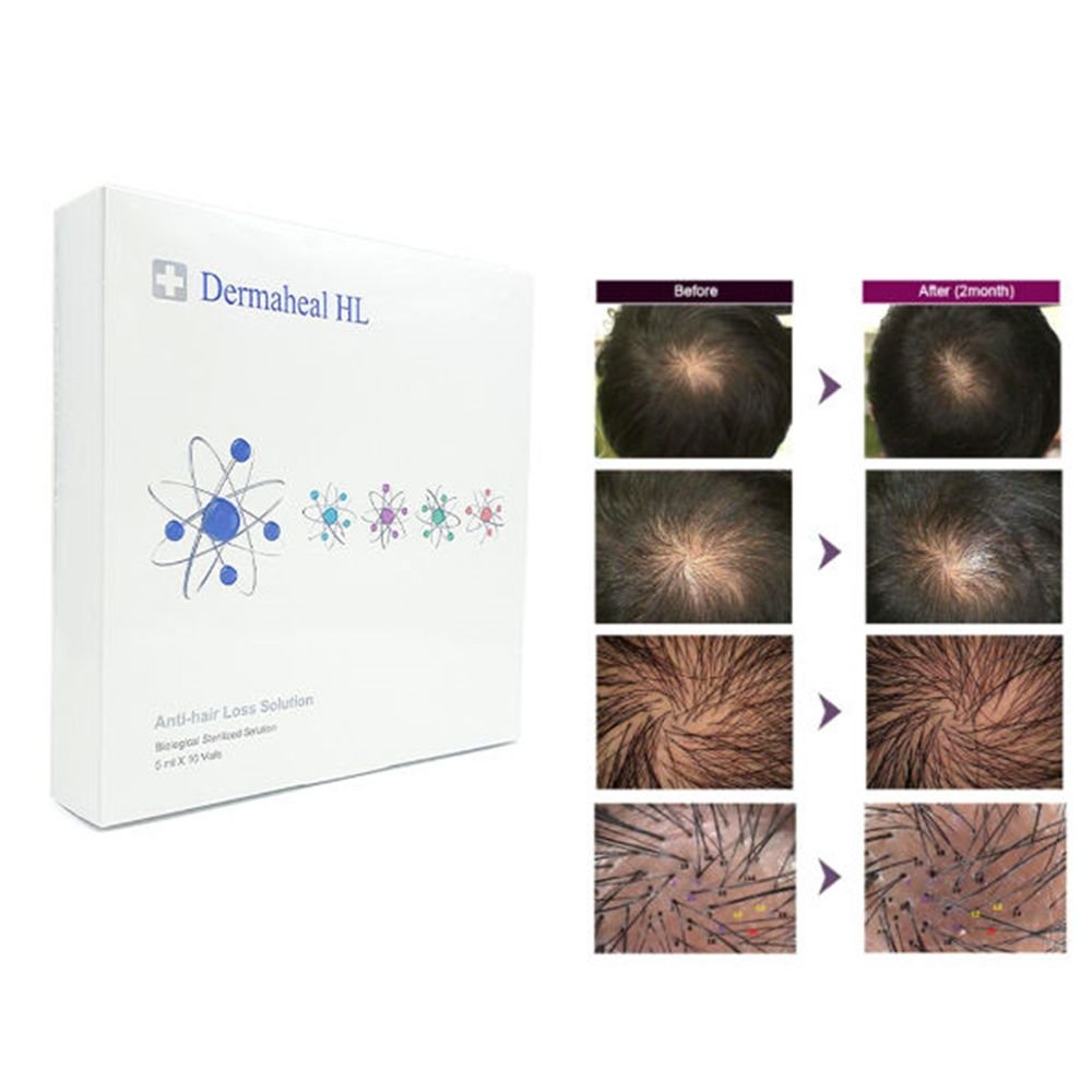 DermaHeal HL Hair Growth Solution - Image 3