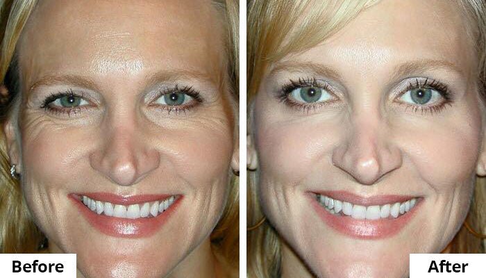 GLO24K 7 Color LED Photon Rejuvenation Super Mask Red Light - Image 3