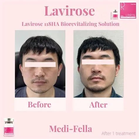 Lavirose 118HA Bio Revitalizing Solution - Image 3