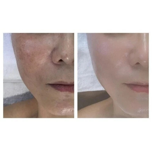 DM Cell - Organic Bio Seacil Exfola Peel Treatment Kit - Image 2