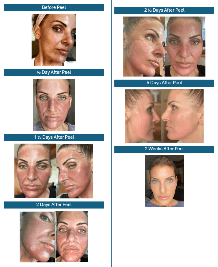 Stayve - Seanergy Spicule Peel - Image 5